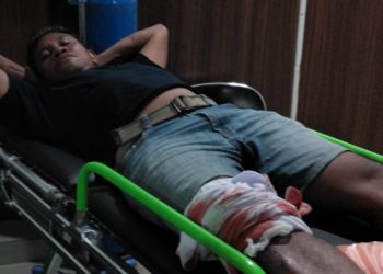 Juru Parkir di Banjarmasin Ditebas Pakai Parang, Diduga Dendam Lama