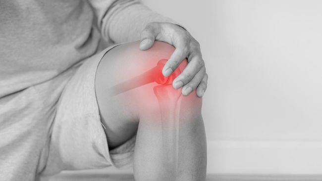 Hati-hati, 6 Kebiasaan Buruk Ini Bisa Jadi Penyebab Radang Sendi